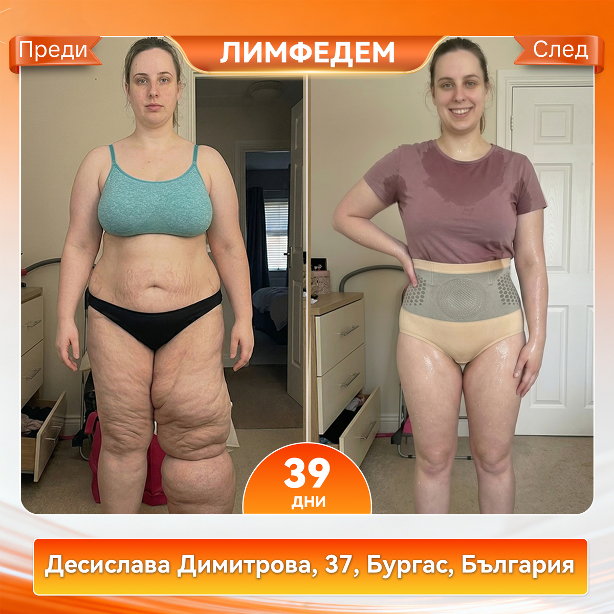Официален магазин |🌰𝐏𝐀𝐔𝐑𝐀𝐉𝐔® 𝟐𝟎𝟐𝟔 МОРИНГА И БЕРБЕРИН 4 B 1 Къси Панталони За Скулптуриране С Микрочастици И Изгаряне На Мазнини